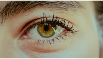 Occhiaie persistenti: consigli e rimedi